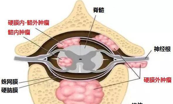 攻略肿瘤医生第11关（以游戏为主）